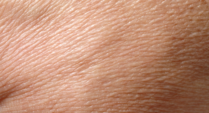A close up image of fine surface level facial wrinkles