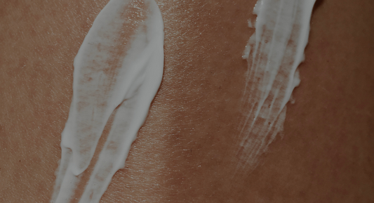 Close up photo of face cream on a person's dry face